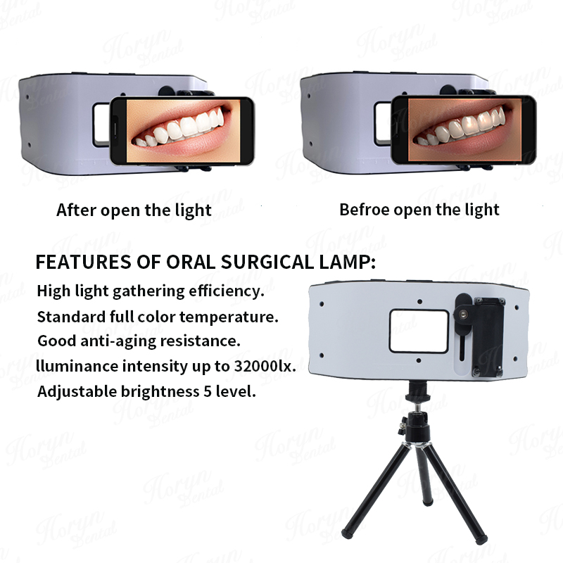 Dental Blitzlicht Fotografie A – Photography Lighting Led Bewertung und Preis
